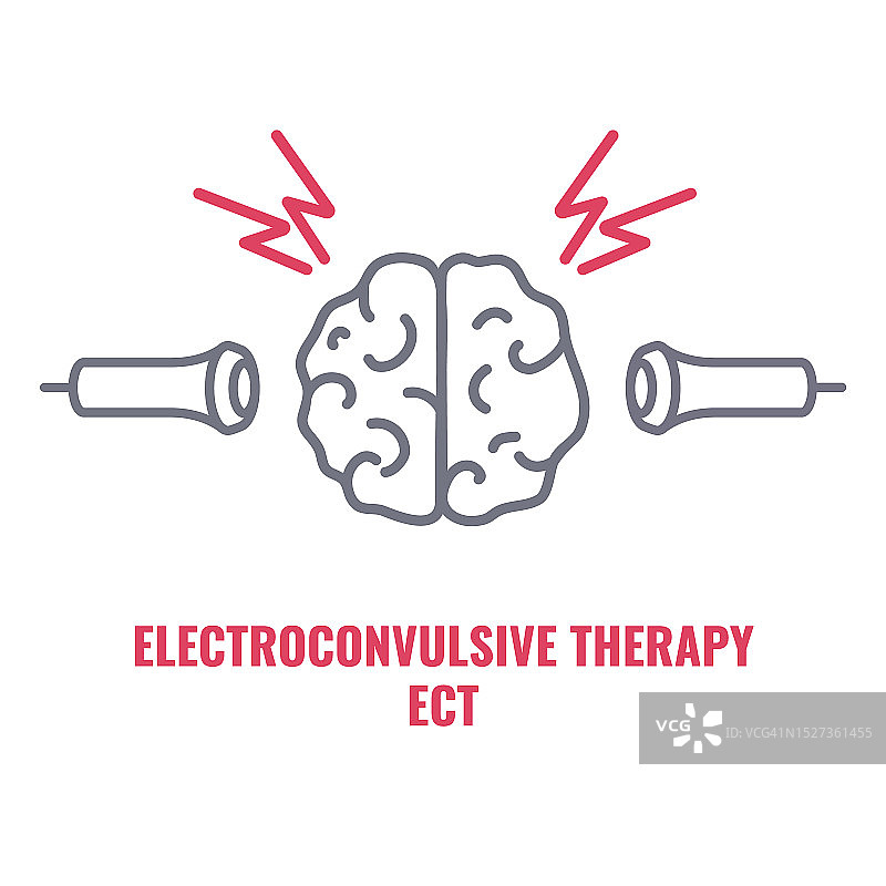 电休克疗法，插图图片素材