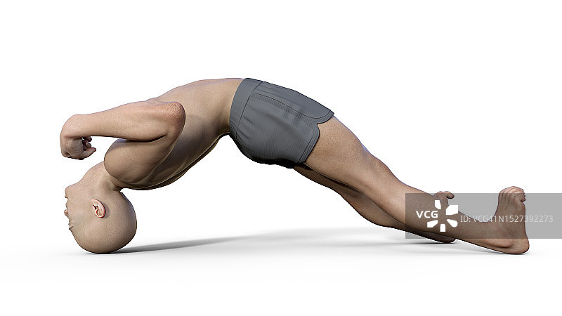 破伤风中的角弓反张插图图片素材