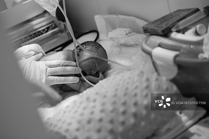 新生儿医疗监护图片素材