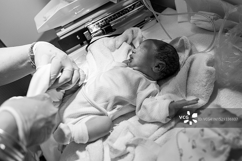 新生儿医疗监护图片素材