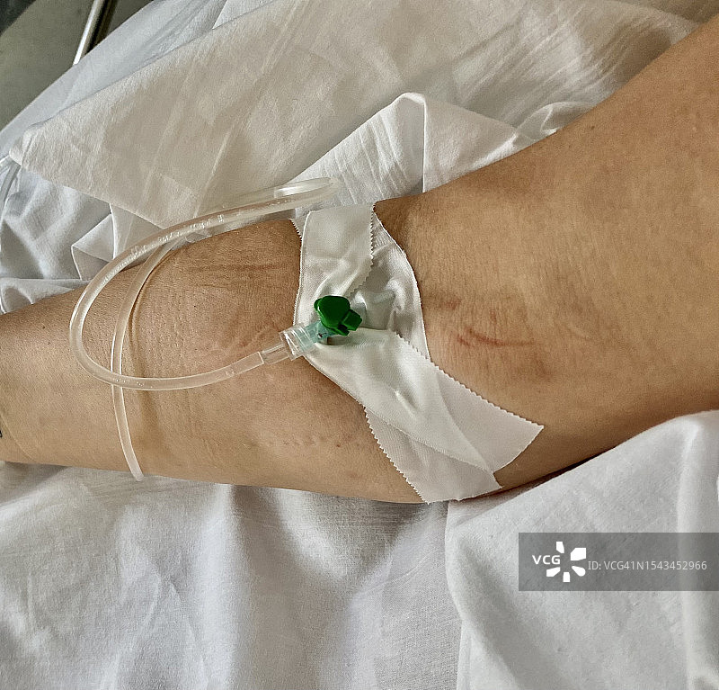 套管针图片素材