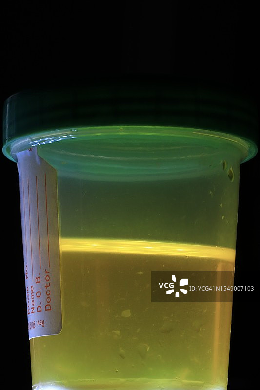 用于药物测试的尿液样本容器图片素材
