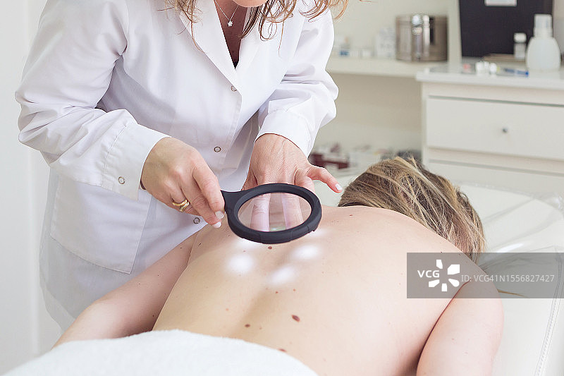 女医生用放大镜检查病人的痣图片素材