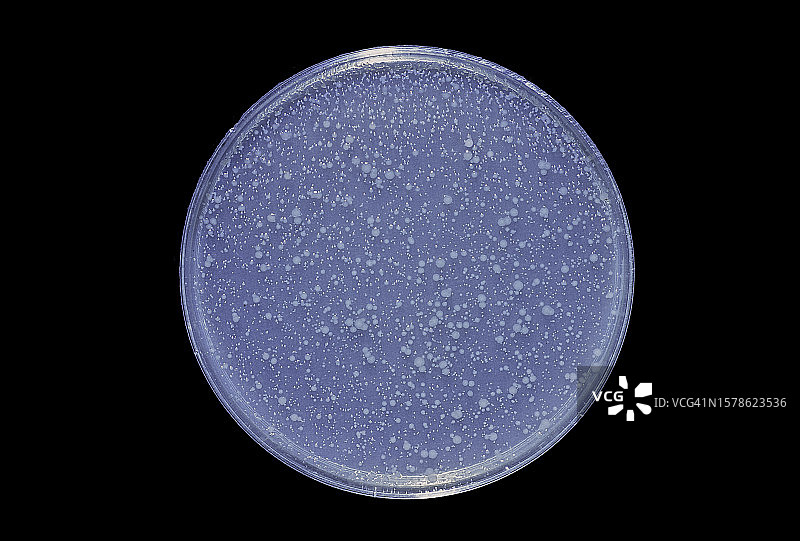 大肠杆菌B - 在抗生素（链霉素）存在下的培养图片素材
