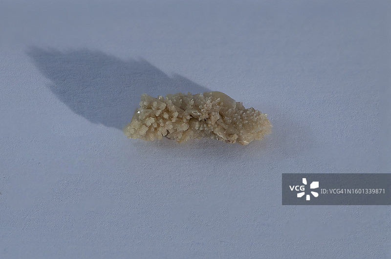 8毫米人体肾结石图片素材