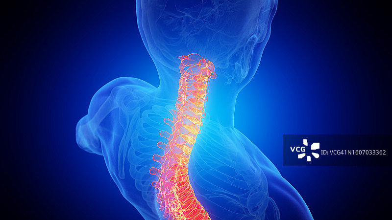 疼痛的上脊柱插图图片素材