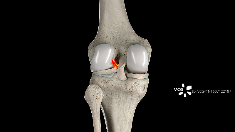 前十字韧带插图图片素材
