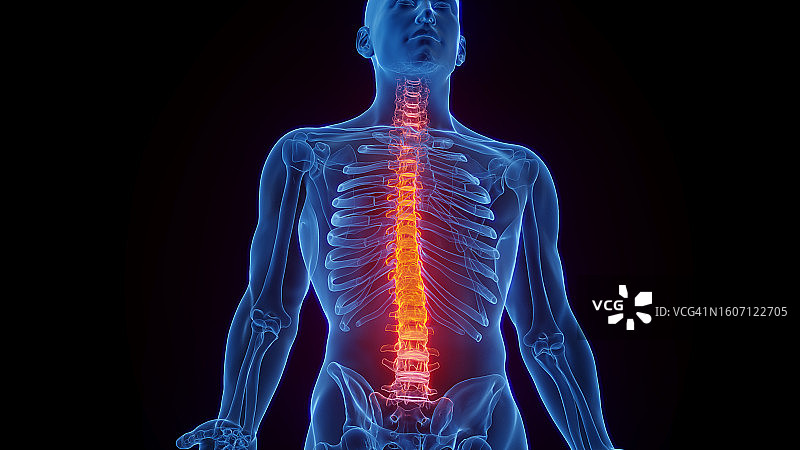 脊柱炎症插图图片素材