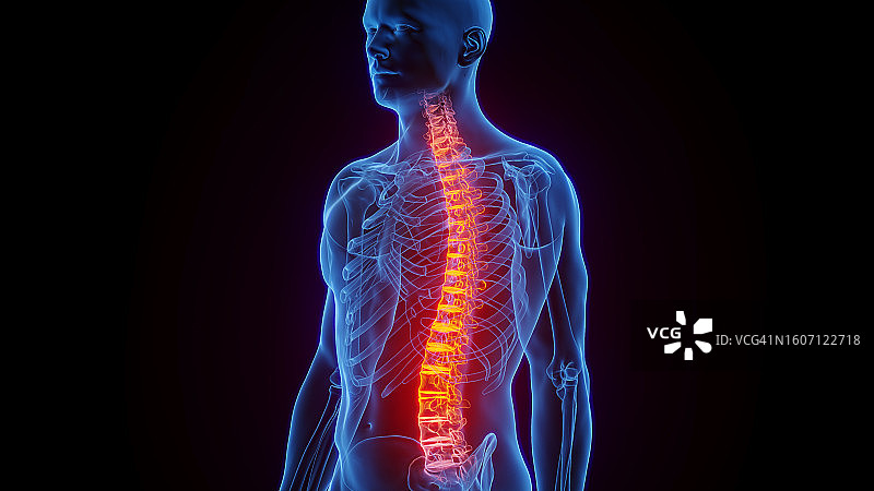 脊柱炎症插图图片素材
