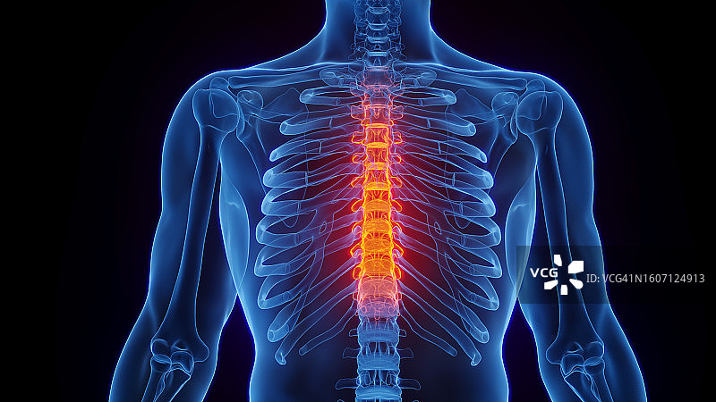 胸椎炎症插图图片素材