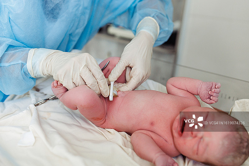 新生儿接受脐带护理的照片图片素材