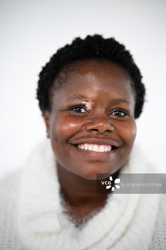 用白癜风突出眼睛和皮肤的自信女人图片素材