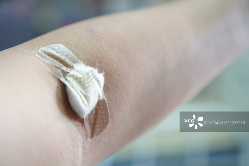 棉花和石膏用于覆盖手臂上的伤口图片素材