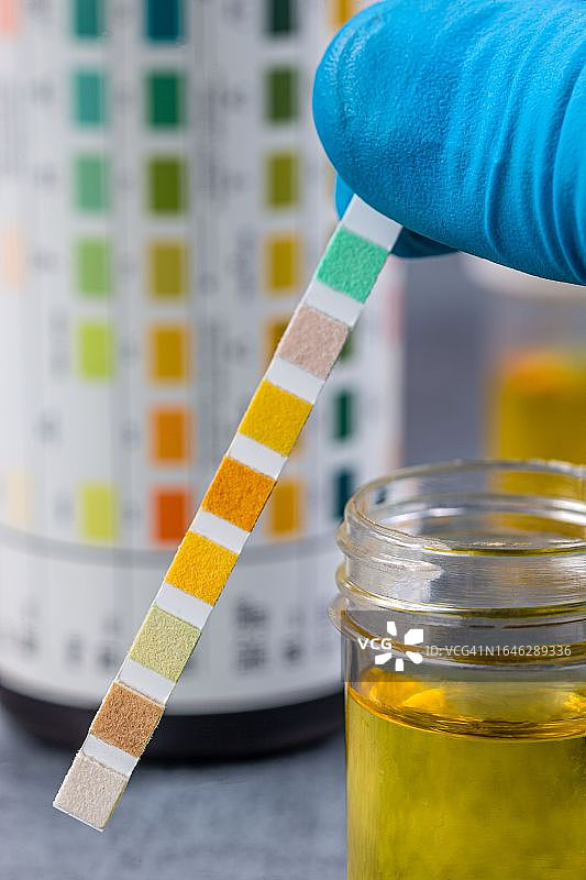 尿液自检-自我测量图片素材