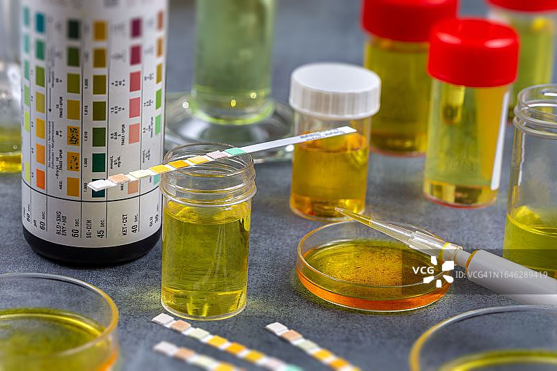 尿液分析图片素材