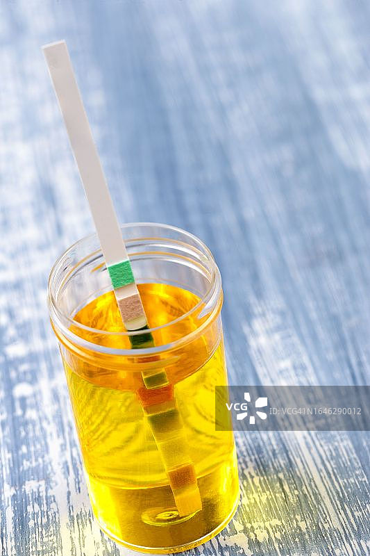 尿液筛查-自测图片素材