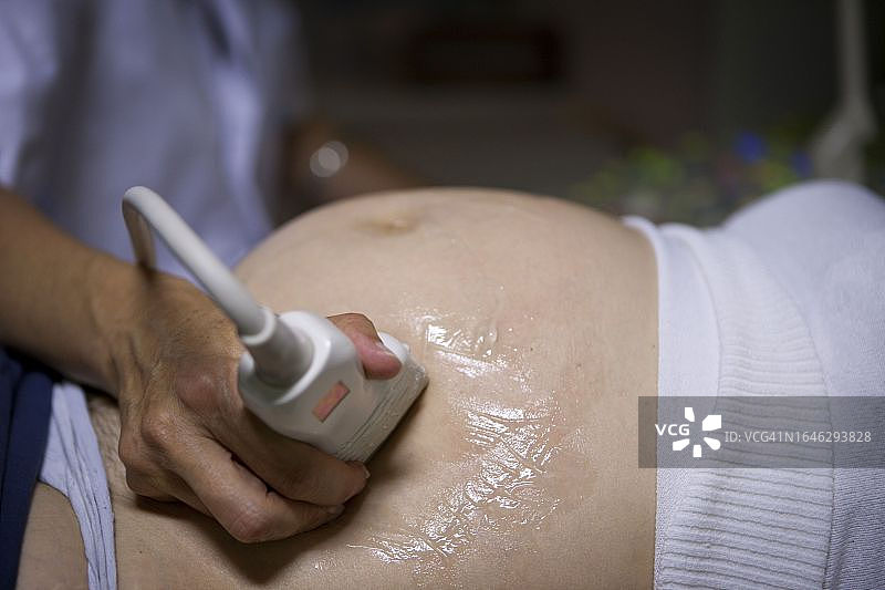 超声波图片素材