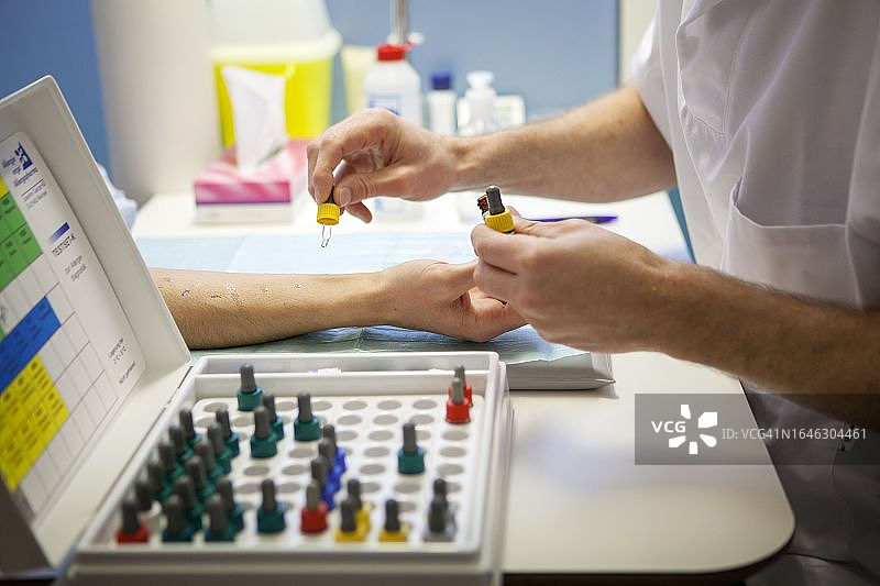 过敏测试图片素材