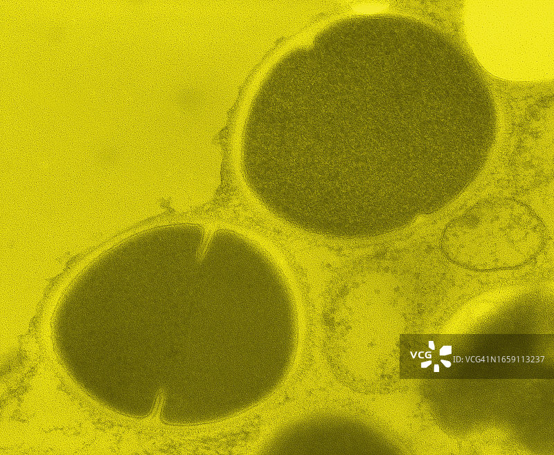 金黄色葡萄球菌培养及电镜8万倍放大图（细胞分裂期）图片素材