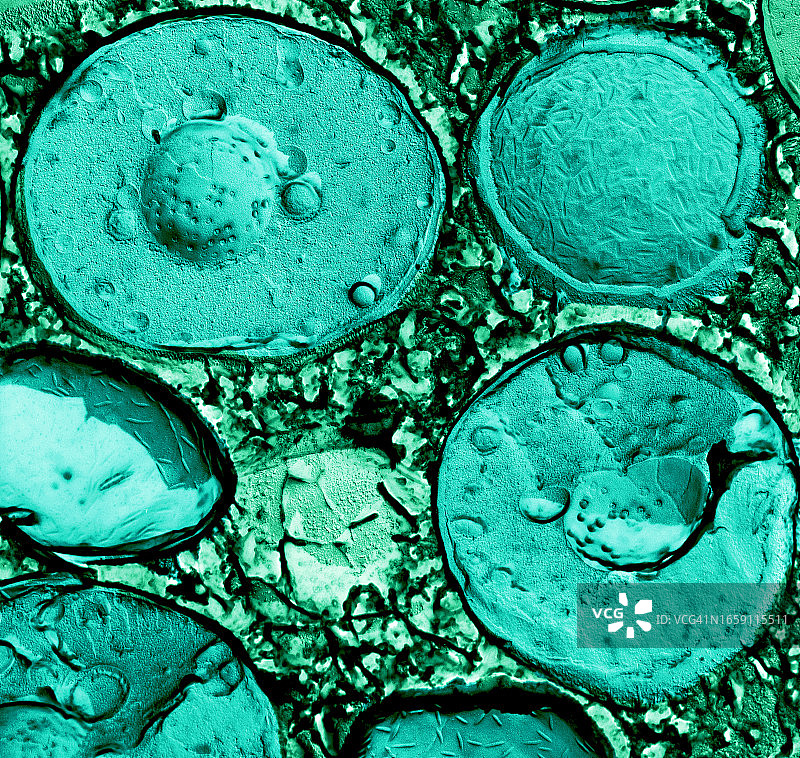 冷冻培养酵母的电镜内部结构照片图片素材