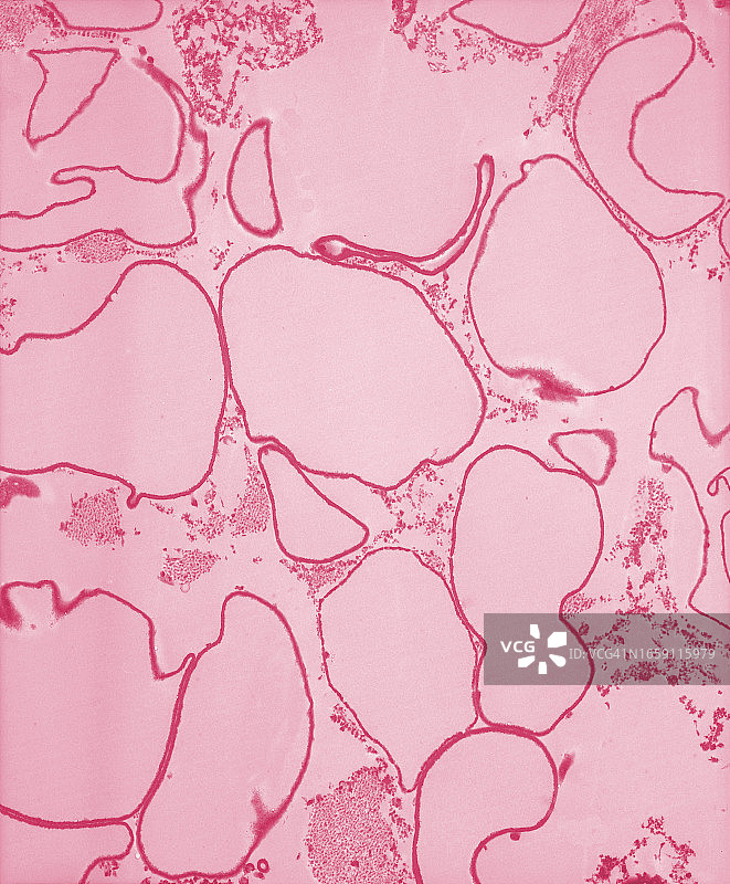 无血红蛋白仅剩细胞膜的红细胞透射电子显微照片图片素材