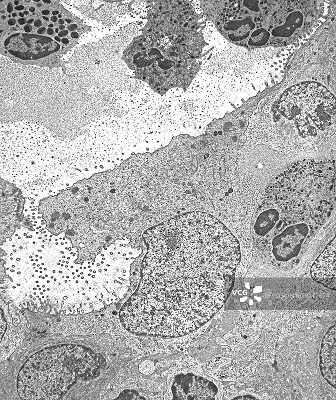 透射电子显微镜拍摄的鼻腔炎症图片素材