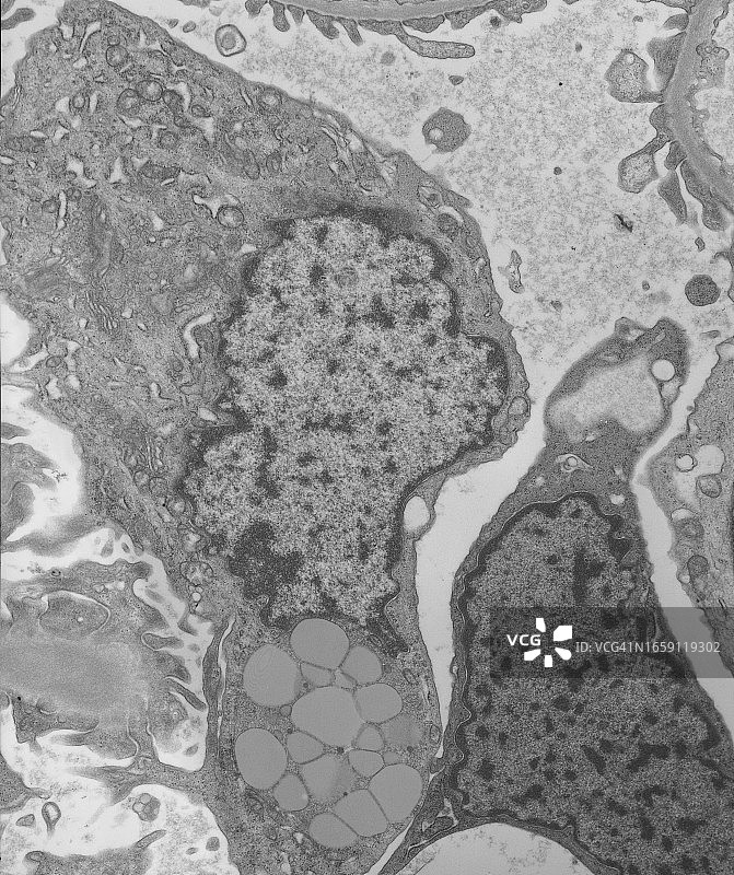 肾小球的透射电子显微照片图片素材