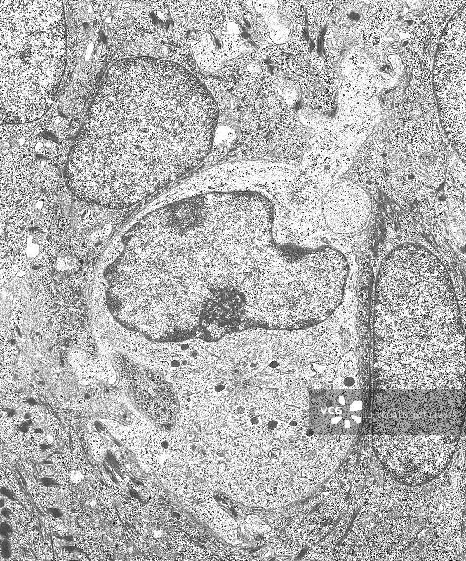 透射电子显微镜下的皮肤朗格汉斯细胞照片图片素材