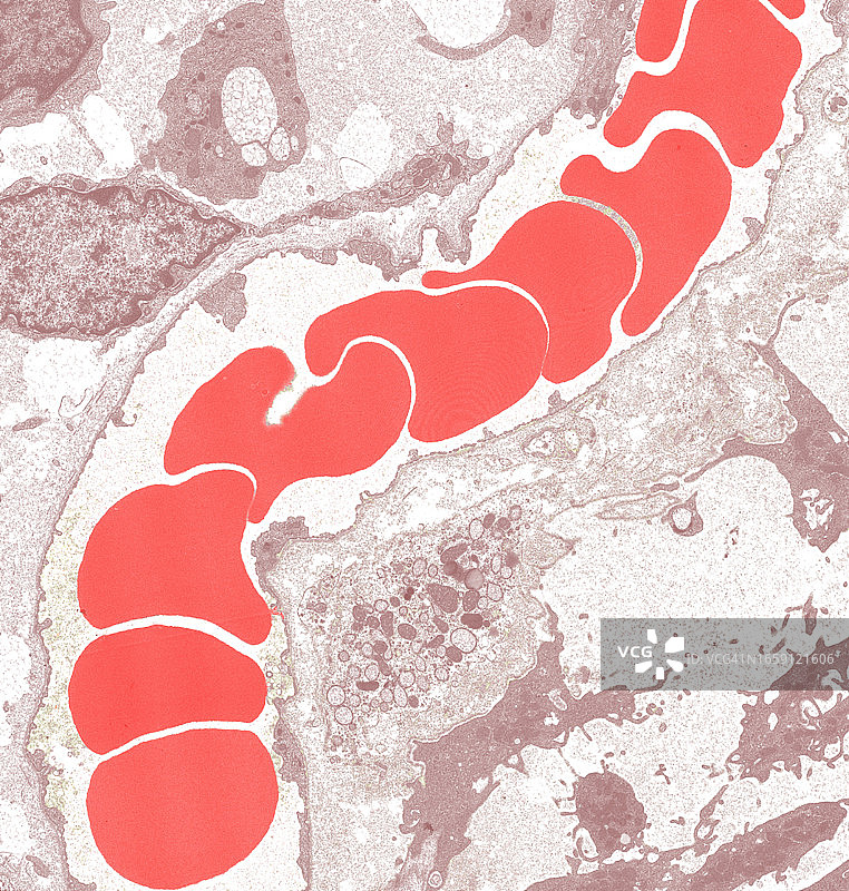 肾毛细血管纵切面的电子显微照片图片素材