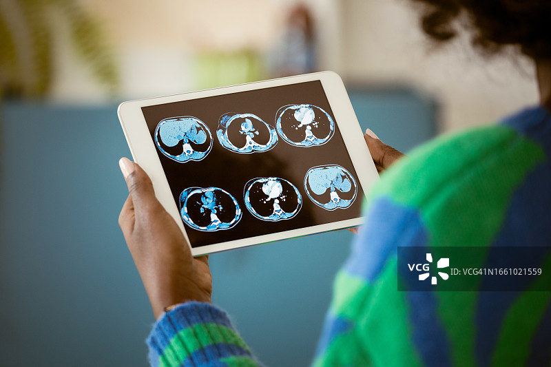 用平板电脑分析MRI扫描结果的女人图片素材