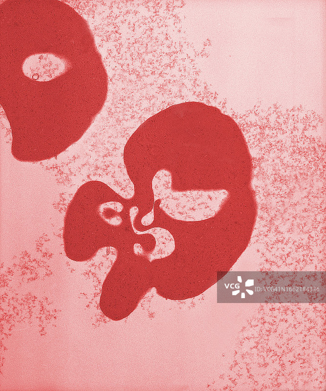 透射电子显微镜下的未成熟红细胞照片图片素材