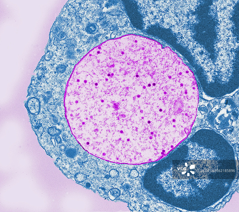 电子显微镜下观察到的正在吞噬腺病毒的白细胞照片图片素材