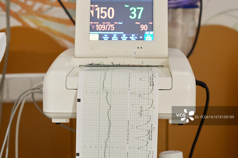 具有屏幕和纸张指标的胎心宫缩监护图片素材
