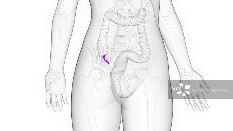 女性阑尾，图示图片素材