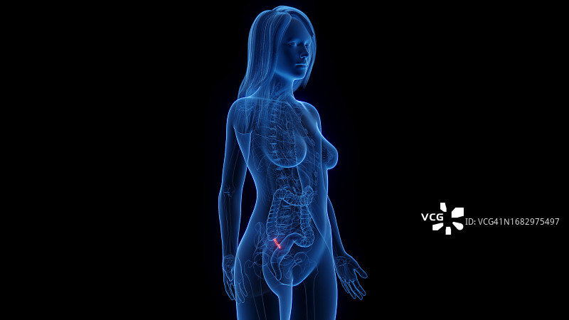 女性阑尾，图示图片素材