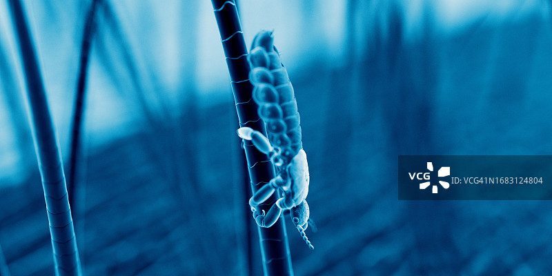 头虱插画图片素材