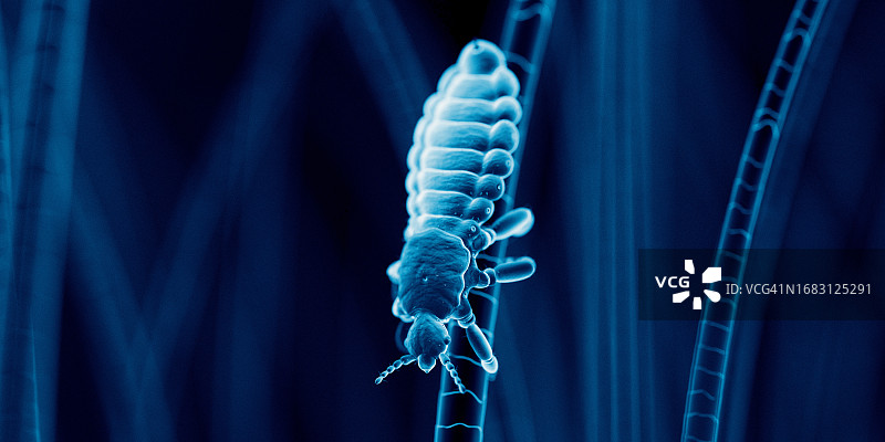 头虱插画图片素材