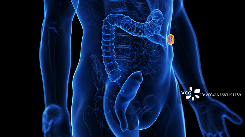 结肠切除术插图图片素材