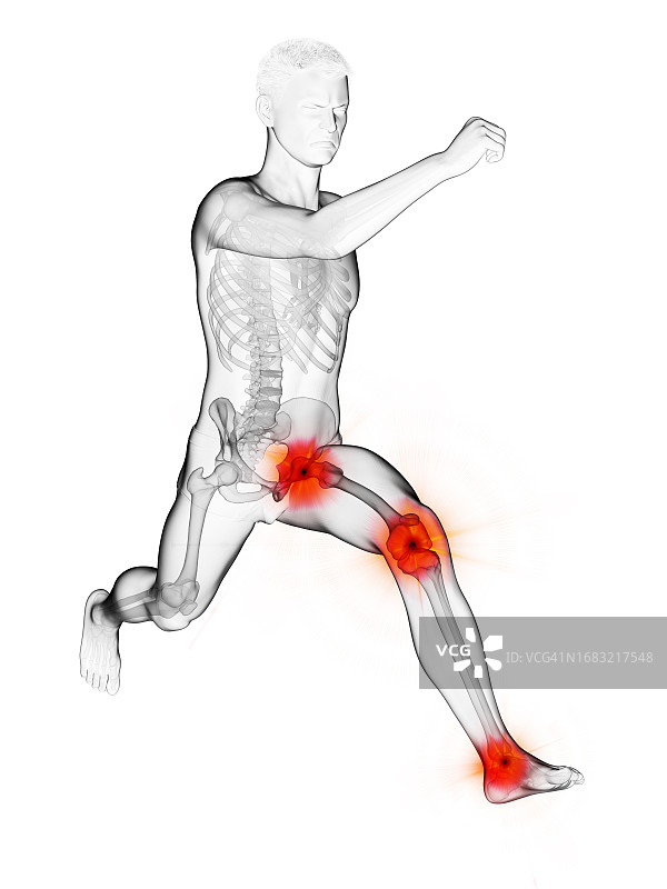 跑步者疼痛的关节插画图片素材