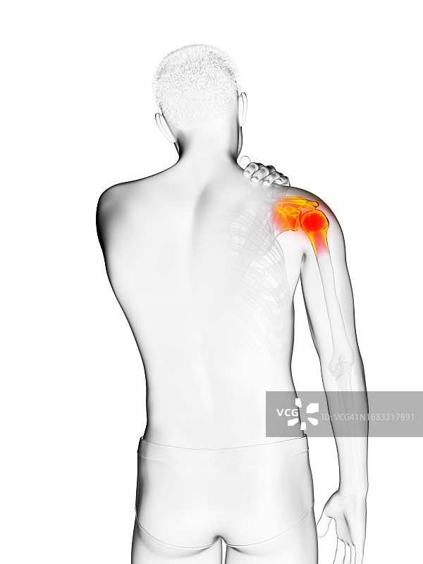 男人肩膀疼痛插画图片素材