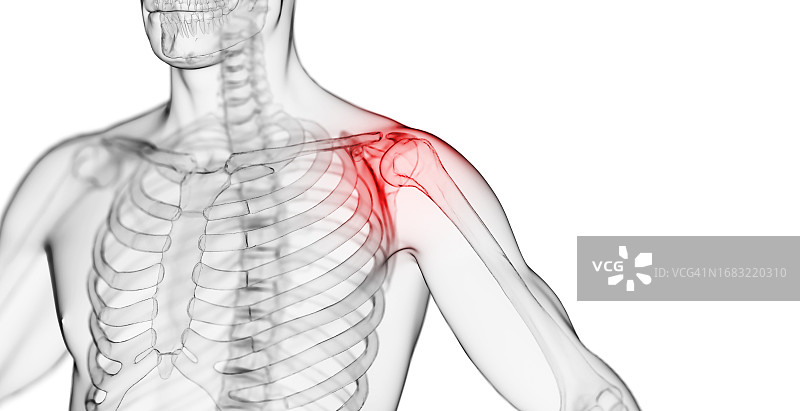 肩部疼痛的男人插画图片素材