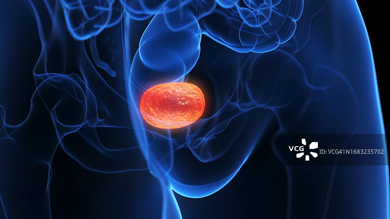 膀胱炎症插图图片素材