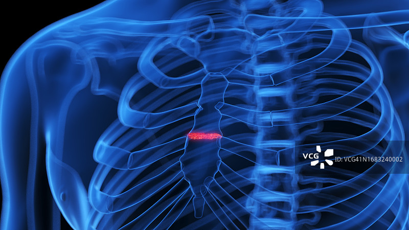 断裂的胸骨插图图片素材