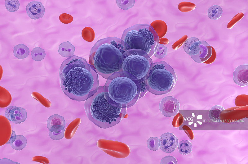 急性髓系白血病插图图片素材