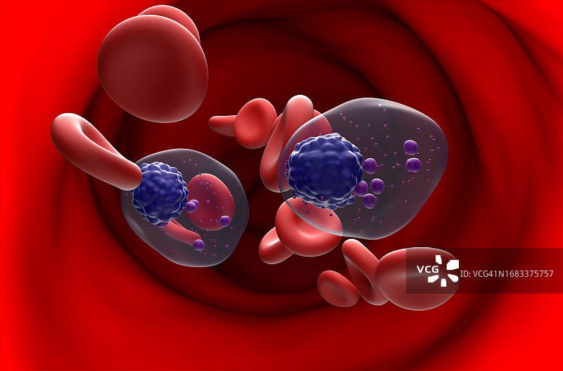 多发性骨髓瘤插图图片素材