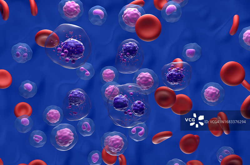 多发性骨髓瘤插图图片素材