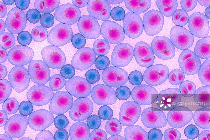 多发性骨髓瘤插图图片素材