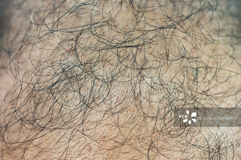 亚洲男人头皮上稀疏头发的全画幅照片图片素材