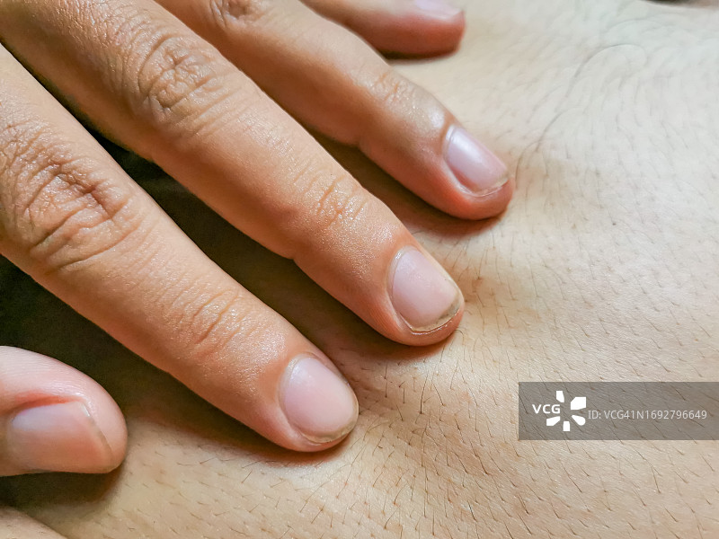 沾满污垢的指甲触碰皮肤图片素材