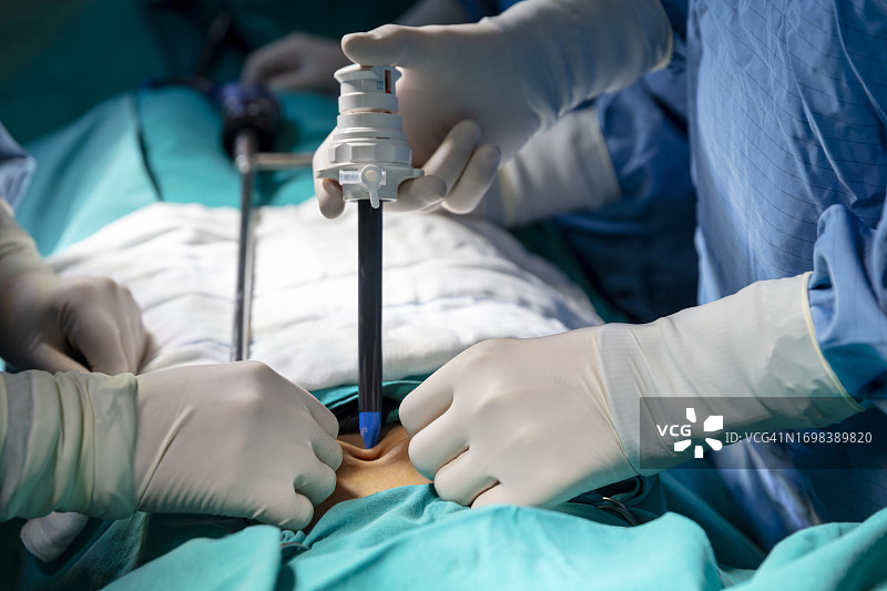 穿着蓝色制服、戴着乳胶手套的外科医生在腹腔镜手术中拿着特殊的医疗器械图片素材